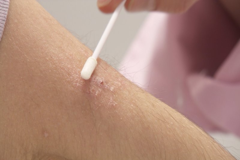 Wunderwaffe Mikrobiom – Bild: 3sat