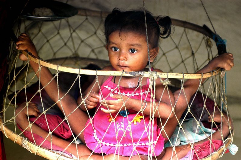 Lakshmi Tatma, dziewczynka z o?mioma ko?czynami /​ Lakshmi Tatma from India was born with a parasitic twin and became known as the girl with eight limbs – Bild: Copyright: Discovery Communications, Inc. For Show Promotion Only – Discovery Networks Picture Publicity. This picture may be used solely for Discovery Networks programme publicity purposes. May be re