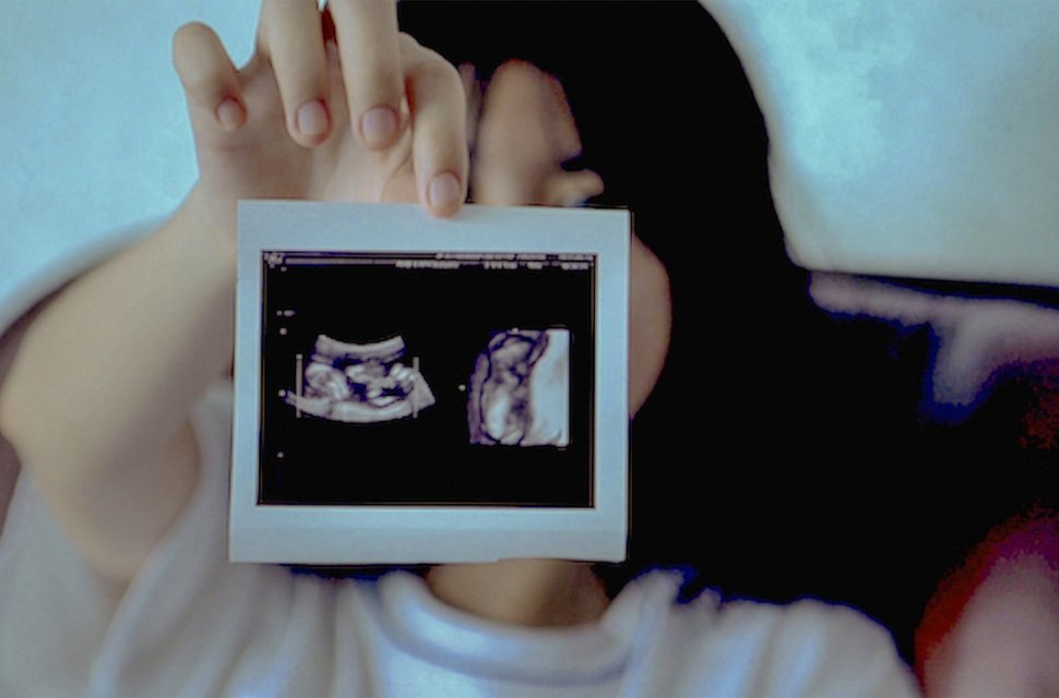 Ein junges Mädchen versteckt sich hinter dem aktuellen Ultraschallfoto ihres Babys. – Bild: SWR / Sun Hee Engelstoft / © SWR / Sun Hee Engelstoft