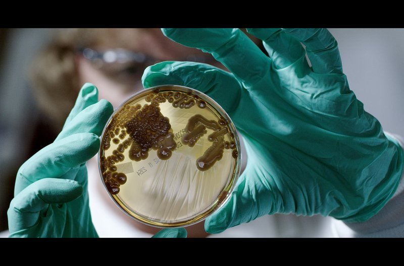 Hier wurden Kulturen von Mikroorganismen in einer Petrischale angelegt. – Bild: Broadview Pictures /​ Hier wurden Kulturen von Mikroorganismen in einer Petrischale angelegt.