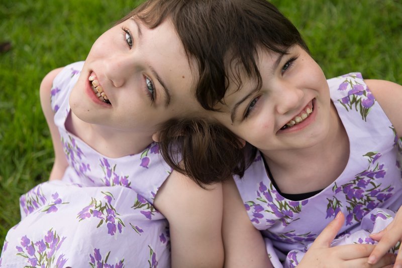 Conjoined twins Tatiana and Krista Hogan close up – Bild: TLC Conjoined twins Tatiana and Krista Hogan close up – Bild: TLC
