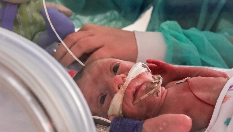 Das 11 Wochen zu früh geborene Baby Jonas im Inkubator. Ernährung per Magensonde mit Muttermilch, Sauerstoff-Unterstützung (CEPAP) über die Nase. – Bild: ZDF und Maja Classen