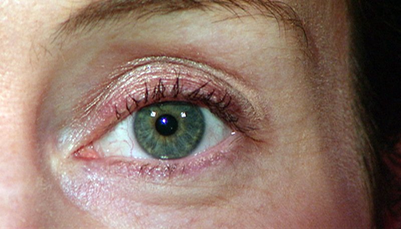 rbb Praxis 198: Der große Augen-Report: Klare Sicht – gesunde Augen ...