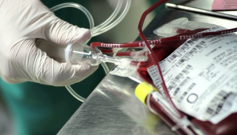 Im Schnitt werden in Deutschlandt 4–5 Millionen Transfusionen pro Jahr, also geschätzte 4 Millionen Liter Blut verbraucht. – Bild: SWR Im Schnitt werden in Deutschlandt 4–5 Millionen Transfusionen pro Jahr, also geschätzte 4 Millionen Liter Blut verbraucht. – Bild: SWR