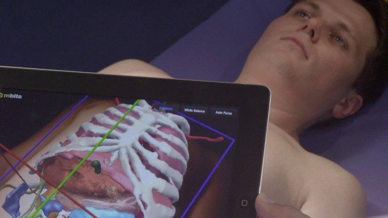 Chirurgen am Universitätsklinikum Heidelberg setzen auf Augmented Reality. – Bild: ZDF und Thomas Bresinsky