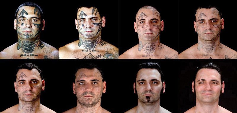 Das „Southern Poverty Law Center“, eine gemeinnützige Bürgerrechtsorganisation, die extremistische Gruppierungen verfolgt und vor Gericht bringt, erklärte sich bereit, die Kosten von Bryons Tattoo-Entfernung zu übernehmen. Auf die Frage, was er heute über die Tattoos in seinem Gesicht denkt, antwortete Bryon: „Sie machen mich krank. Sie erinnern mich ständig an einen Teil meines Lebens, mit dem ich abgeschlossen habe.“ – Bild: WELT