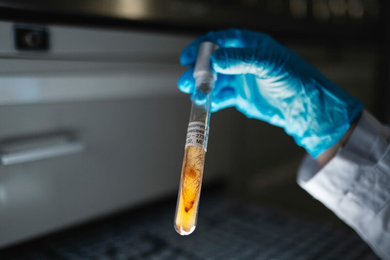 Einzigartig in Deutschland ist die Stammsammlung von circa 50 000 Mikroorganismen der Jena Microbial Resource Collection (JMRC). Als eine der weltweit größten Sammlungen enthält sie Isolate von rund 15 000 Pilze und 35 000 Bakterien. – Bild: ZDF und Leibniz-Institut für Naturstoff-Forschung und Infektio/Leibniz-Institut für Naturstoff– Einzigartig in Deutschland ist die Stammsammlung von circa 50 000 Mikroorganismen der Jena Microbial Resource Collection (JMRC). Als eine der weltweit größten Sammlungen enthält sie Isolate von rund 15 000 Pilze und 35 000 Bakterien. – Bild: ZDF und Leibniz-Institut für Naturstoff-Forschung und Infektio/Leibniz-Institut für Naturstoff–