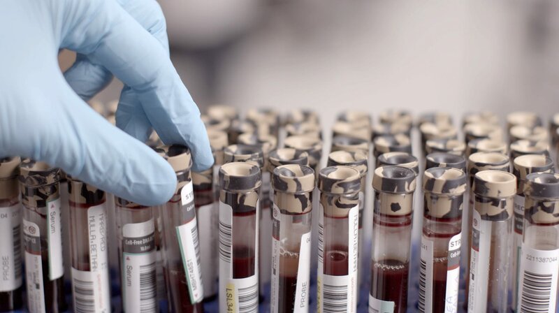 Im mütterlichen Blut befinden sich etwa ab der zehnten Schwangerschaftswoche auch Schnipsel des Erbguts vom Kind. – Bild: WDR/Längengrad Filmproduktion GmbH Im mütterlichen Blut befinden sich etwa ab der zehnten Schwangerschaftswoche auch Schnipsel des Erbguts vom Kind. – Bild: WDR/Längengrad Filmproduktion GmbH