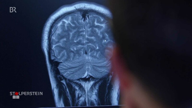 Aufnahme eines Gehirnscans. – Bild: br Aufnahme eines Gehirnscans. – Bild: br