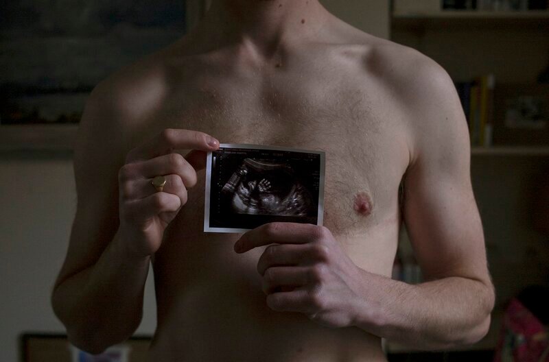 Freddy, schwanger, mit einem Ultraschall Bild seines Kindes. – Bild: WDR/​Danny Burrows