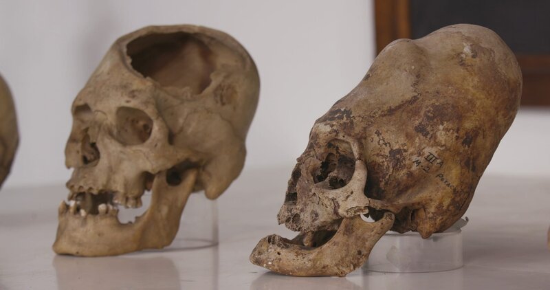 In der Nasca-Kultur band man Kindern Bretter an den Kopf, um ihre Schädel zu verlängern. – Bild: ZDF und One Planet./​One Planet