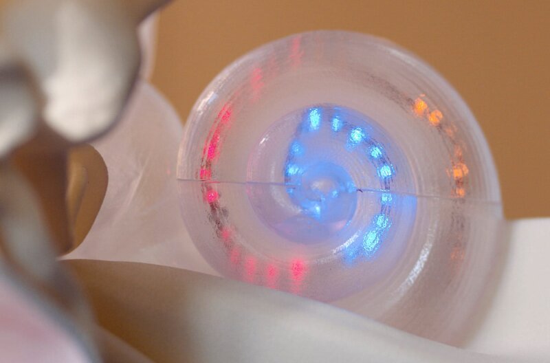 Das optogenetische Cochlea-Implantat-Modell versucht, die nicht mehr auf Schall reagierenden Nerven im Innenohr durch physikalische Lichtstimulanz zu aktivieren. – Bild: Ralph Loop /​ © Ralph Loop