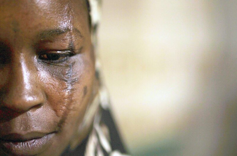 Eine Frau mit Narbe im Gesicht: Diese ist nur eine von vielen, die ihr hauptsächlich im Rotlichtviertel Tudun James von Männern zugefügt wurden. – Bild: arte