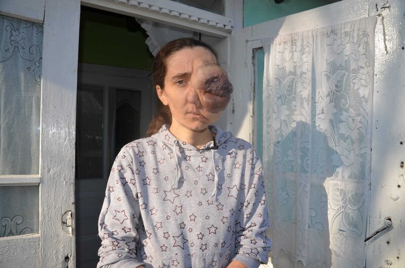 Body Bizarre Unglaubliche Schicksale S04E04 Folge 4 (Born With Three