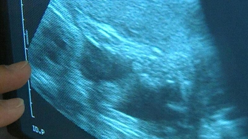 Computertomografie und Ultraschalldiagnostik – Bild: BR/​ARD