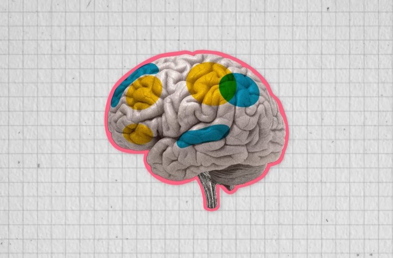 Was passiert im Gehirn von Menschen mit ADHS? – Bild: SWR