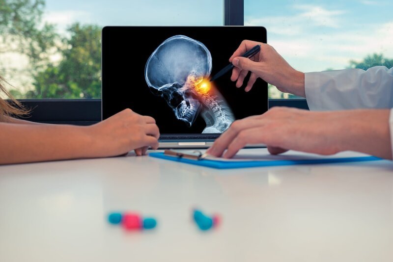 Doctor showing a x-ray of skull with pain in top of the neck on a laptop to a woman patient. – Bild: Shutterstock /​ Shutterstock /​ Copyright (c) 2019 steph photographies/​Shutterstock. No use without permission.