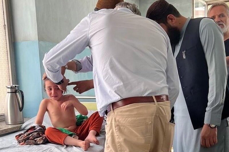 SRF DOK Im Reich der Taliban – Ein Schönheitschirurg auf humanitärer Mission Enrique Steiger auf Visite im Maiwand Hospital in Kabul SRF – Bild: SRF1
