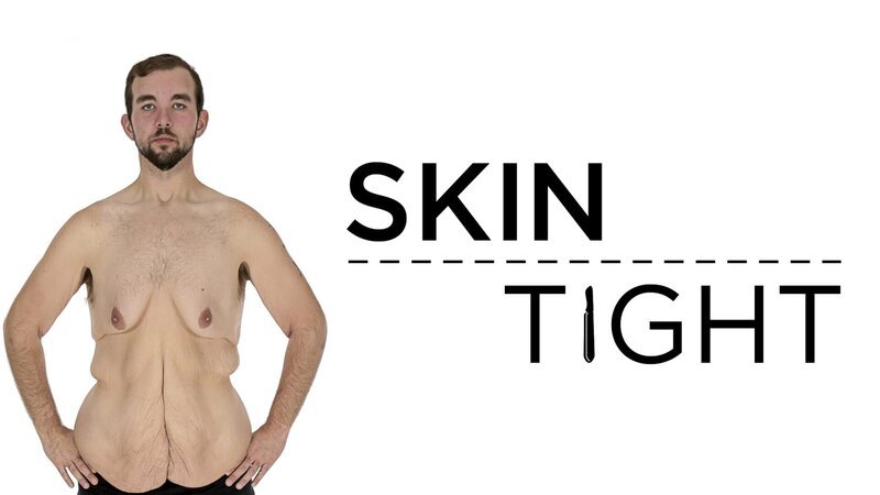 Skin Tight – key art. – Bild: TLC