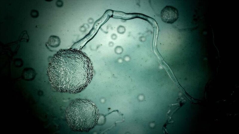 CGI of strep virus. – Bild: Discovery Communications, Inc.