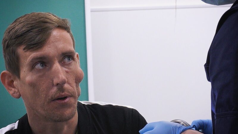 Craig has many cysts that disfigured his face – Bild: TLC