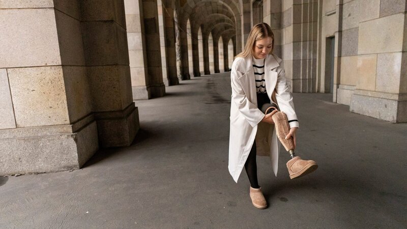 Anna Osicki zeigt ihre Prothese offen. Sie will sich in der Öffentlichkeit nicht verstecken und anderen ein Vorbild sein. – Bild: Lawrence Richards
