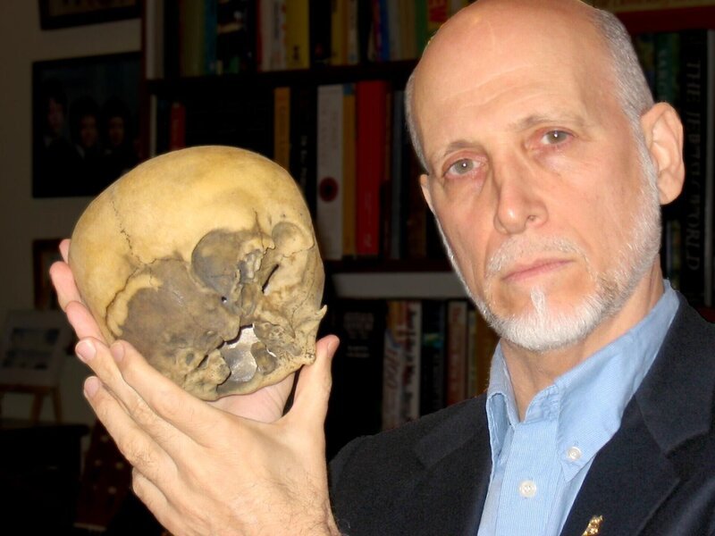 Wissenschaftler untersuchen Erbgut und menschliche Überreste, von vermeintlichen Wunderkindern aus der Geschichte. Ist es möglich, dass diese Kinder Zugang zu einer „Alien“-DNA haben? – Bild: Lloyd Pye /​ The Starchild Project Lizenzbild frei