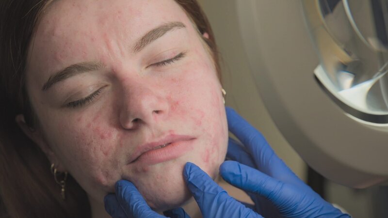 Close up profile of Kayleigh’s face as Dr Emma inspects it. Dr Emma’s hands in shot … – Bild: 2021, Discovery, Inc. All Rights Reserved.