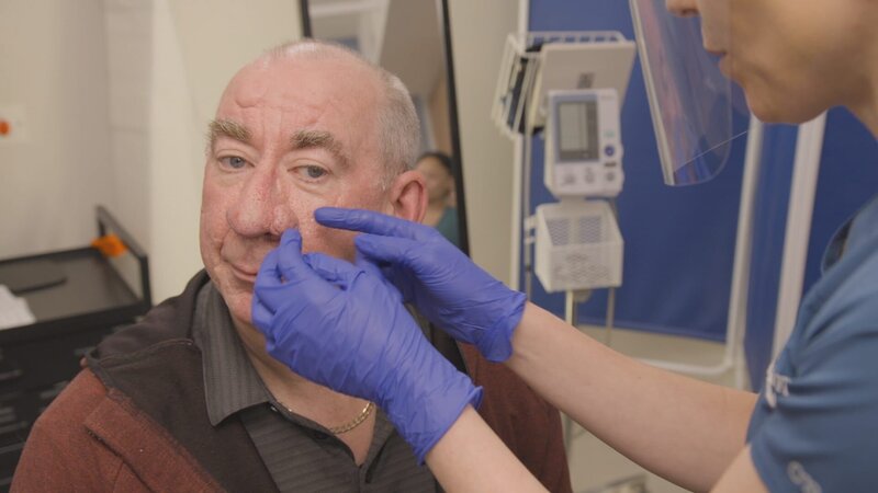 Close up of Dr Emma’s hands inspecting Kevin Sullivans nose Rhinophyma. – Bild: 2021, Discovery, Inc. All Rights Reserved.