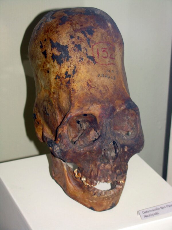 Alien Knochenstruktur im Schädel – Bild: HISTORY Photocredit Mandatory, Editorial Use Only, No Archive, No Resale