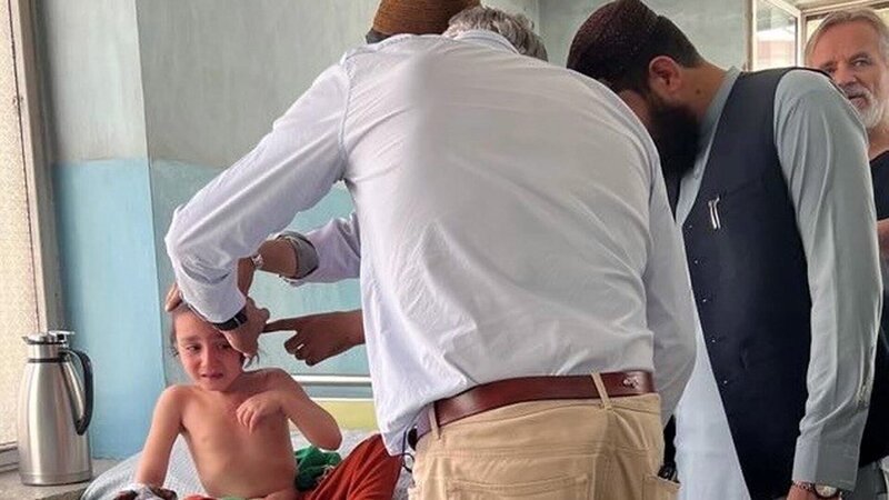 Enrique Steiger auf Visite im Maiwand Hospital in Kabul – Bild: SRF Enrique Steiger auf Visite im Maiwand Hospital in Kabul – Bild: SRF
