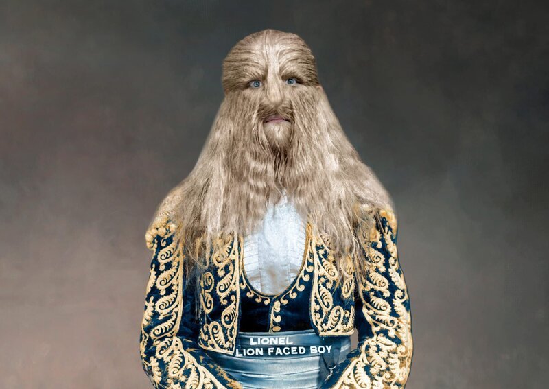 Bibrowsky, Stephan – Side Show Performer, Germany*1890–1932+- ’ Lionel the lion faced man ’ has Hypertrichosis – Photographer: – undatedVintage property of ullstein bild – Bild: ullstein bild via Getty Images
