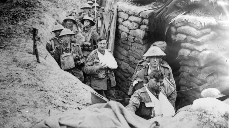 Das Foto zeigt verwundete britische Soldaten der 27. Brigade, 9. Division, in einem Schützengraben an einem Hilfsposten des Regiments in der Nähe des Outtersteene-Kamms. – Bild: RTL /​ Public Domain – U.S. Library of Congress