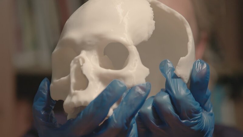 Schädel von besiegten Feinden wurden von den Legionären als Trophäen ausgestellt. – Bild: ZDF