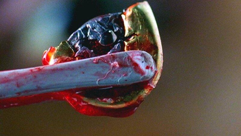 Bei der Obduktion der Toten wird die Kugel untersucht. Jetzt steht fest, dass auch das zweite Opfer aus kurzer Distanz mit einem Kopfschuss in die linke Schläfe erschossen wurde. – Bild: SUPER RTL