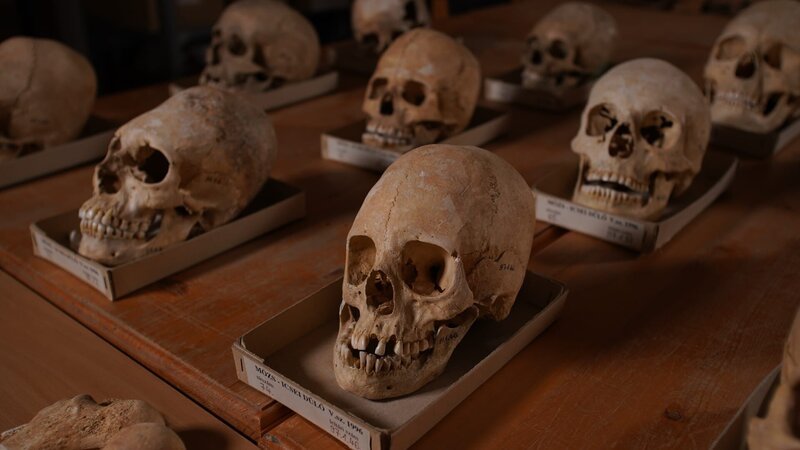 Schädel mit der für Hunnen typischen „Turmform“ aus dem spätrömischen Gräberfeld bei Mözs-Icsei im heutigen Ungarn. – Bild: Daniel Firnigel /​ BR, Blink Films