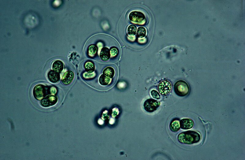 Detailaufnahme von Cyanobakterien – Bild: ServusTV /​ Getty Images