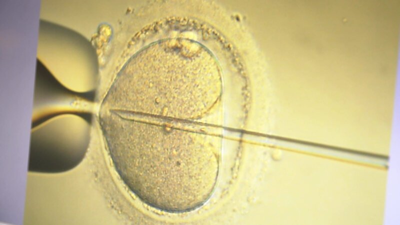 Artificial insemination – Bild: SPIEGEL TV
