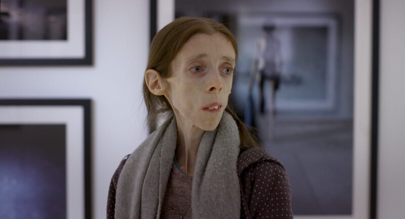 Lene Marie oder das wahre Gesicht der Anorexie – Bild: ARTE/​BR/​Speranza Film Norwegen