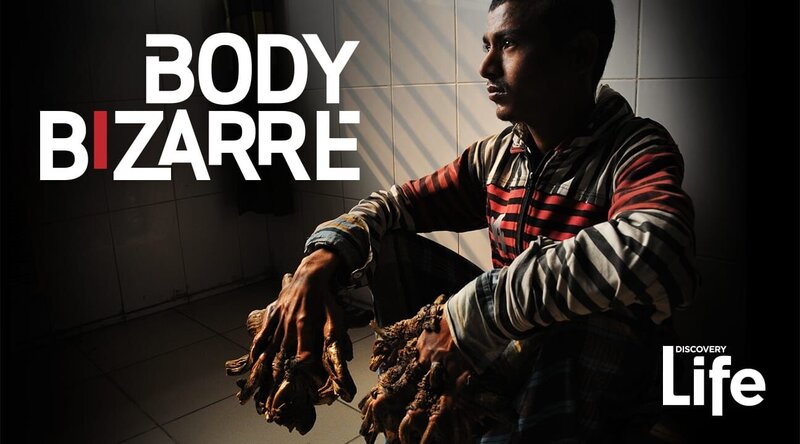 Bild: CH Media /​ Discovery Communications