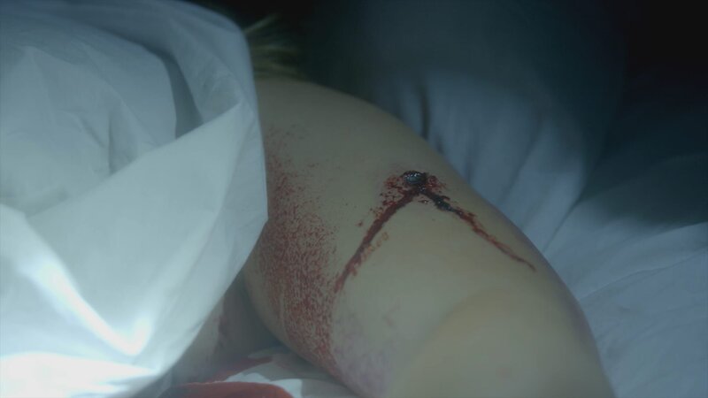 Wunde an einem toten Körper – Bild: Discovery Communications