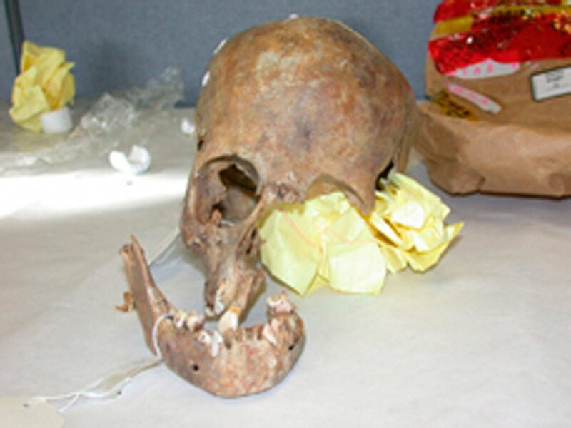 Der Schädel – Bild: Crime + Investigation /​ A+E Networks