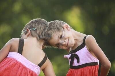 Anastasia and Tatiana Dogaru from Chicago, USA, are joined at the head – Bild: port.hu