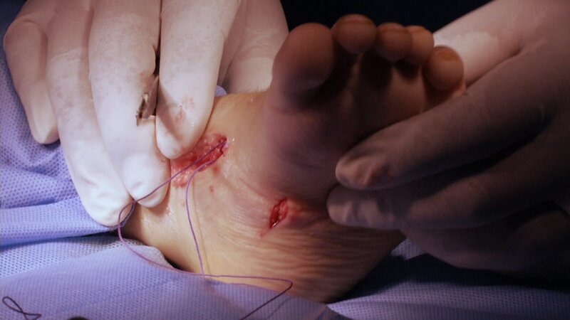 Peruvian boy has corrective surgery on his sideways feet. – Bild: CH Media /​ Discovery Communications
