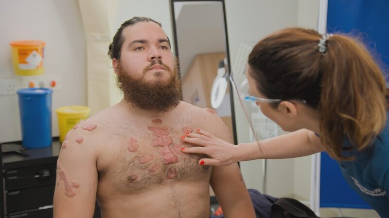 MS of Dr Emma examining Mauricio’s keloids at the clinic – Bild: TLC