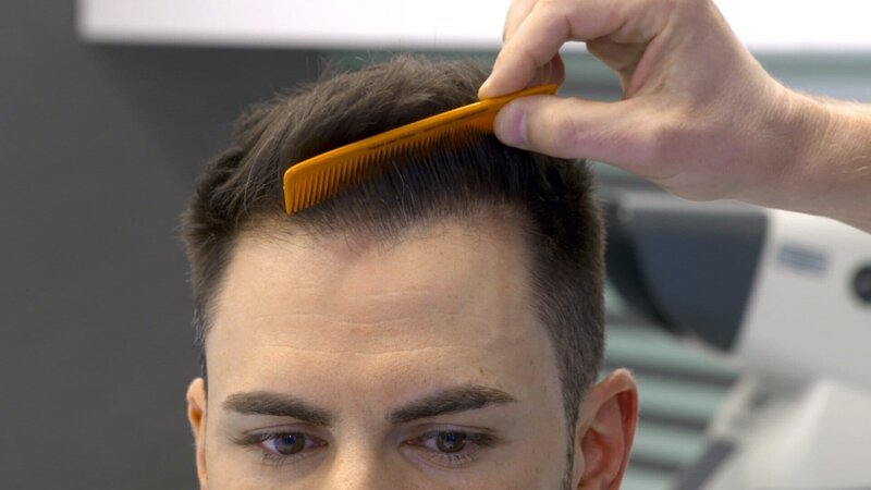 Viele Menschen trennen sich nur schwer von ihren Haaren – Haarverlust gilt vielen als sichtbarstes Zeichen des Älterwerdens. Entsprechend breit und teuer ist die Produktpalette der Kosmetik-Industrie aufgestellt, die alle kahlen Stellen zu beseitigen verspricht. Um die Hoffnungen, die hier geweckt werden, ist ein Zig-Millionen-Markt entstanden. Was von den Mitteln taugt wirklich etwas? Muss es immer ein Industrieprodukt sein, oder helfen auch Naturmittel? Im Gespräch mit Dermatologen und Betroffenen zeigt die Sendung den aktuellen Forschungsstand zu diesem Thema. Im Bild: Moser Medical Group in 1130 Wien, Haaranalyse. – Bild: ORF, Schnittstelle