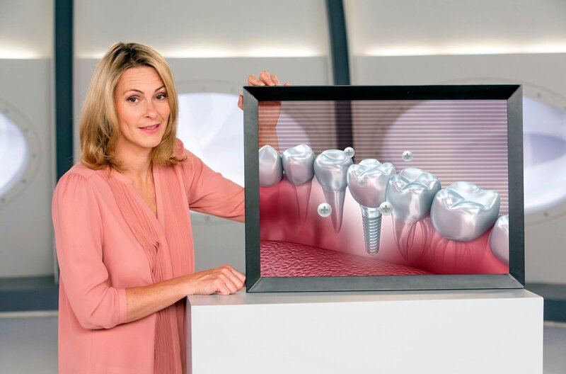 Wenn man schon einen Zahn verliert, so kann man in Zukunft über das Zahnimplantat nicht nur Lücken schließen, sondern auch dafür sorgen, dass der Rest des Gebisses von Karies verschont bleibt. Anja Reschke stellt die neuen High-Tech-Implantate vor – bei Wissen vor acht – Zukunft. – Bild: ARD/​Michael Boehme