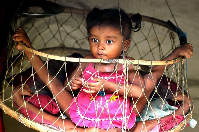 Lakshmi Tatma from India was born with a parasitic twin and became known as the girl with eight limbs – Bild: Discovery Communications, Inc.