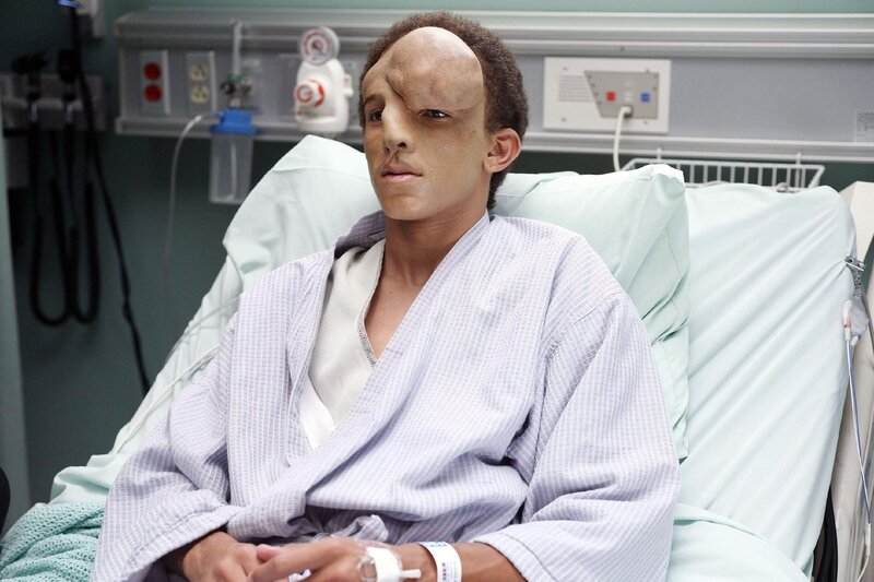 Kenny (Khleo Thomas) ist verzweifelt. Eine Wucherung in seinem Gesicht macht es ihm unmöglich ein normales Leben zu führen. Dr. House ist seine letzte Hoffnung … – Bild: RTL