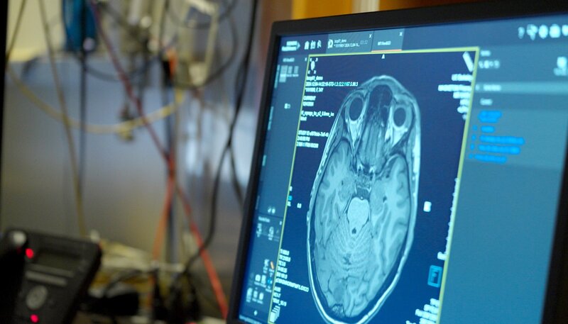 Wissenschaftler:innen weltweit haben Hoffnungen, dass der Wirkstoff der Pilze helfen kann gegen psychische Krankheiten, wie Depressionen, Angststörungen. Die Forschungen sind noch am Anfang – noch ist unklar, wie genau Psilocybin im Gehirn wirkt – Bild: SWR